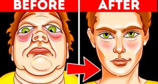 Get Slim Face And Defined Jawline Already In a Month (Just 3 Minutes a Day!)